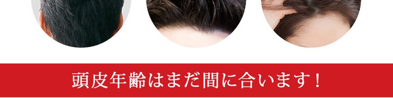 �r�^�u���b�hC�w�A�[���T�C�g